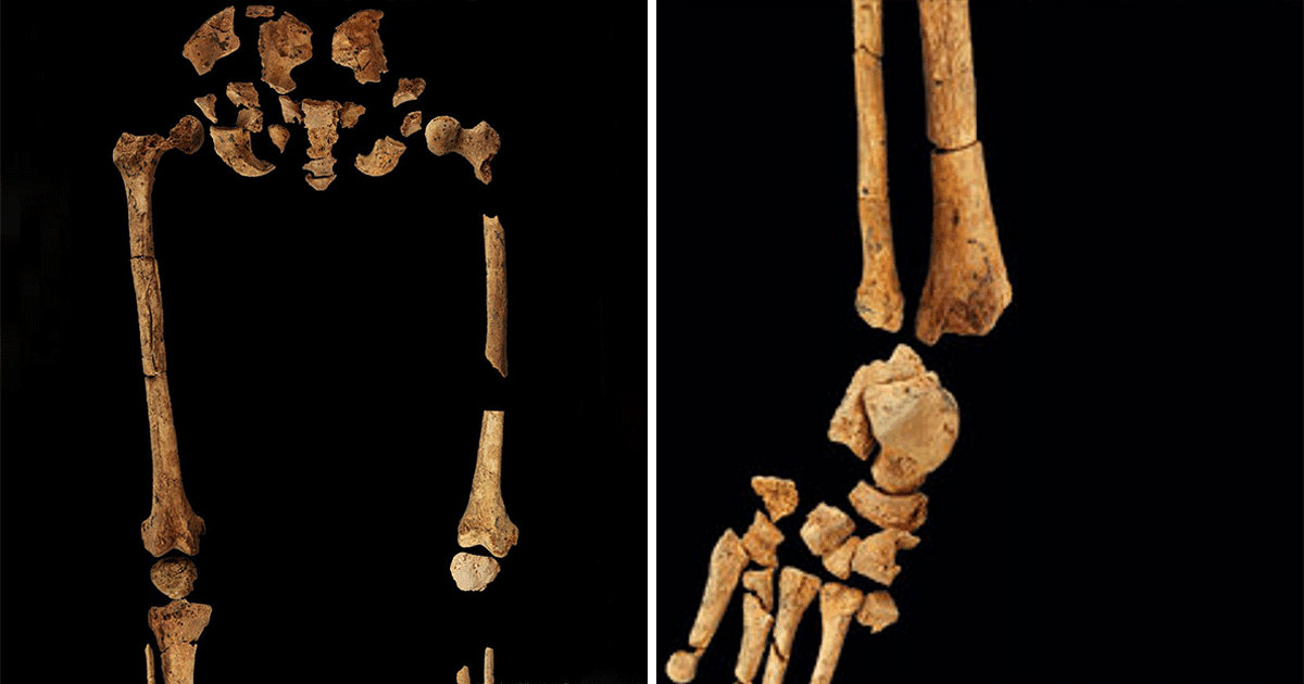 अंग-विच्छेदन की प्रक्रिया से होता था इलाज, 3100 साल पुराने कंकाल से हुआ प्रमाणित