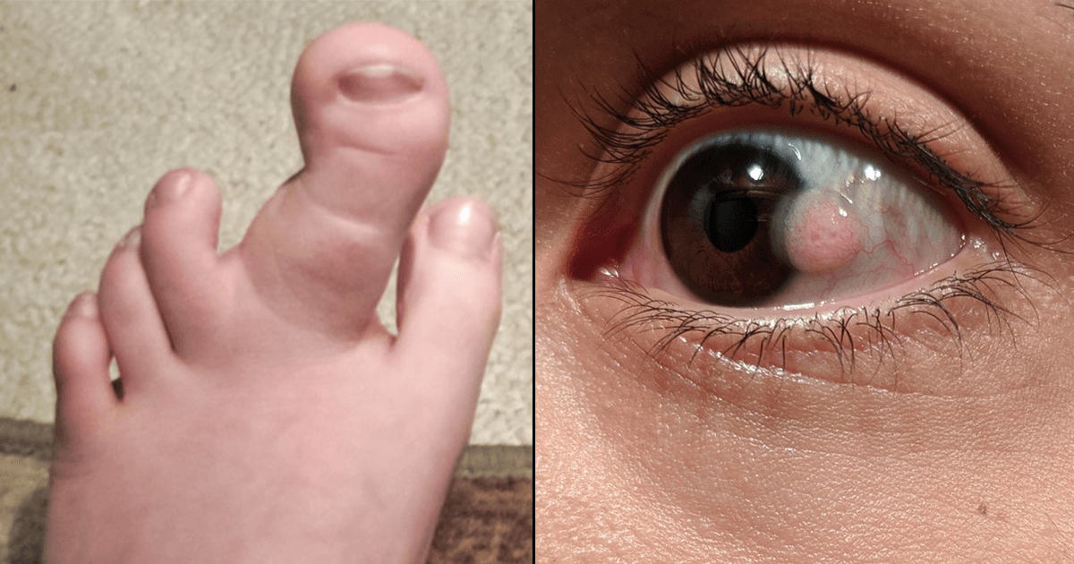 हैरत में डाल देगा इन 12 चीज़ों का अनोखा रूप, वाक़ई कुदरत को समझना नामुमक़िन है