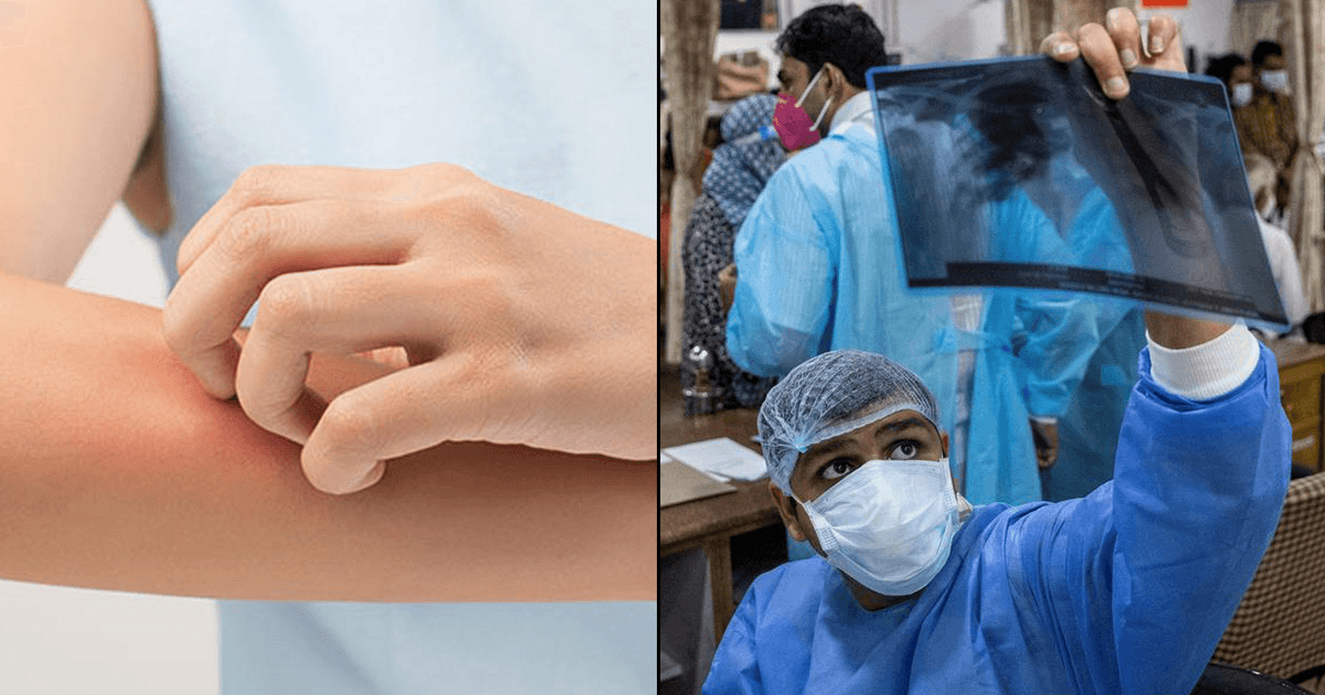 इंसानों के लिए ख़तरनाक हैं ये 19 Fungal Infection, पढ़ें पूरी जानकारी