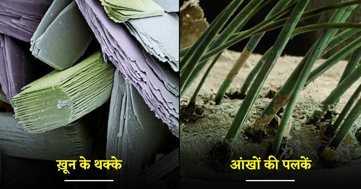 माइक्रोस्कोप से ली गयीं वो 15 तस्वीरें, जिनको देखकर अपनी आंखों से यकीन उठ जाएगा