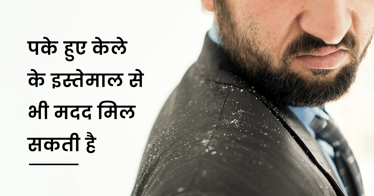 Home Remedies: सर्दियों में पुरुष Dry Scalp और Dandruff से बचने के लिए अपनाएं ये 8 देसी उपाय