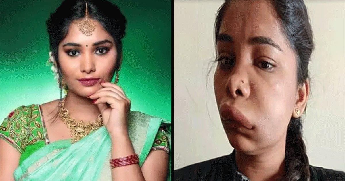 जानिए रूट कैनाल सर्जरी के फ़ेल होने के 8 संकेत, जिससे गुज़र रही हैं कन्नड़ एक्ट्रेस स्वाति सतीश