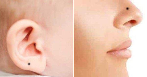 आपकी कुंडली और हस्तरेखाएं ही नहीं, तिल भी होते हैं आपके भाग्य और चरित्र के सूचक