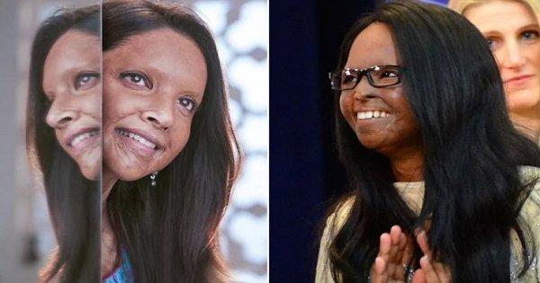 ‘छपाक’ का असर! उत्तराखंड सरकार एसिड अटैक सर्वाइवर को हर महीने 10,000 रुपये पेंशन देगी