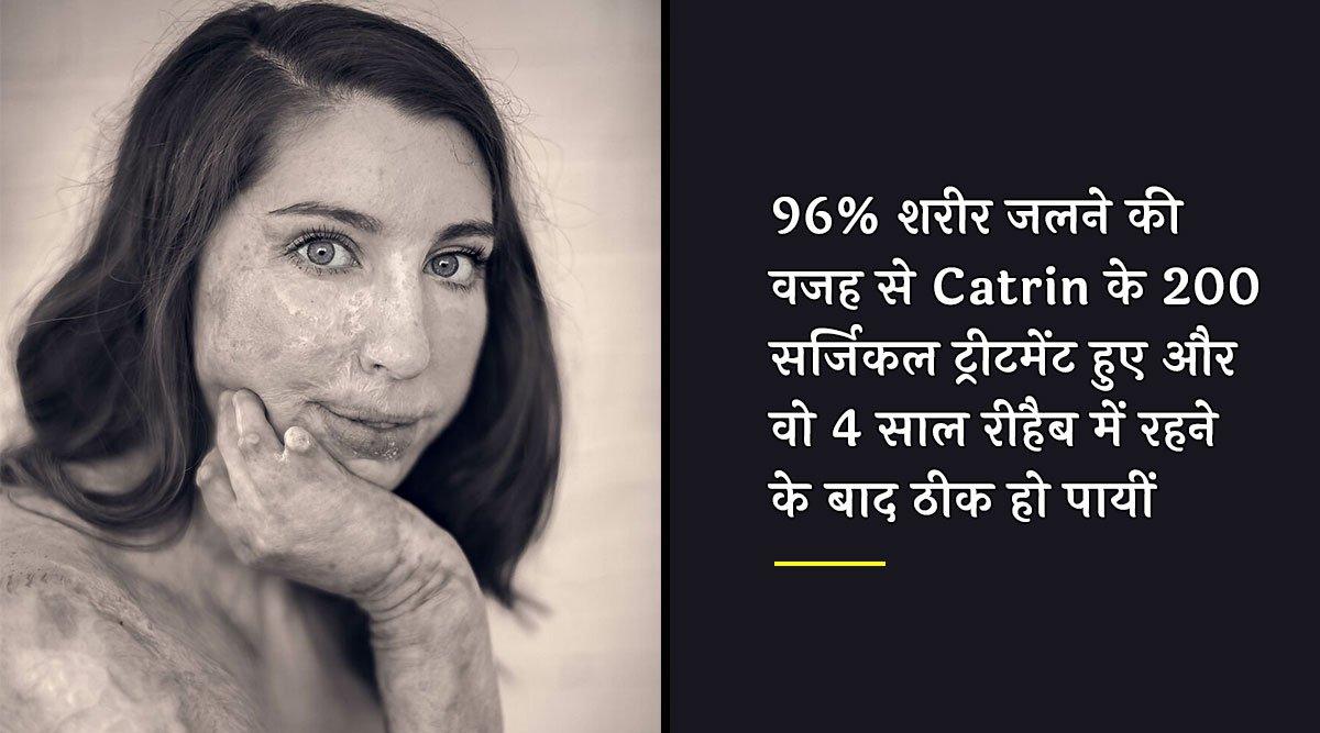 इन 6 महिलाओं की कहानी जानने के बाद ख़ूबसूरती के प्रति नज़रिया पूरी तरह बदल जाएगा